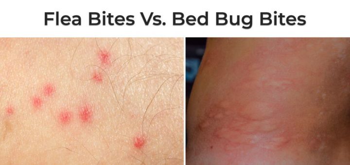 bed bug bites vs flea bites symptoms: what do the bites look like